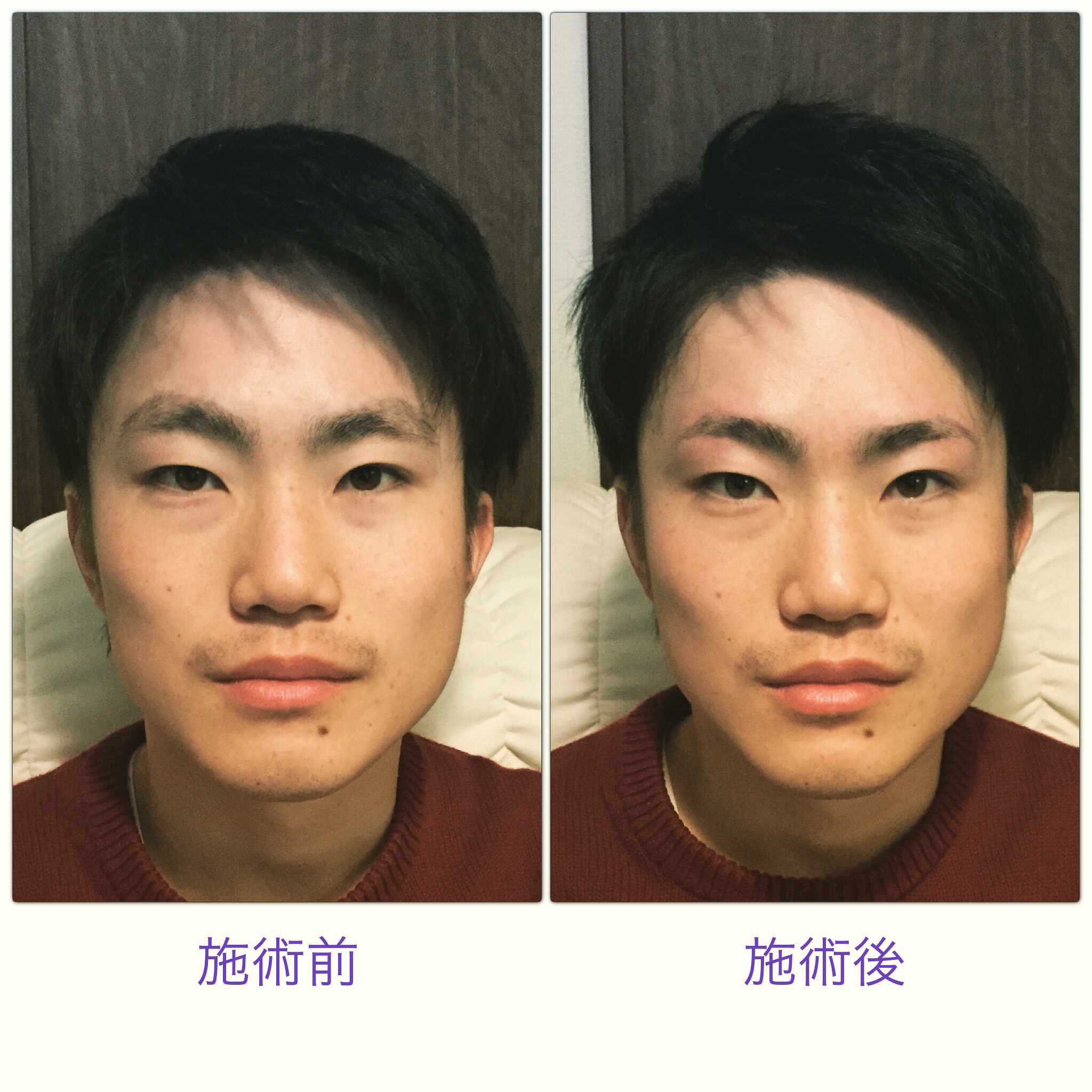 ビフォーアフター 横浜のメンズ専用の眉サロン眉男革命だから出来る眉デザインが人生革命を起こす