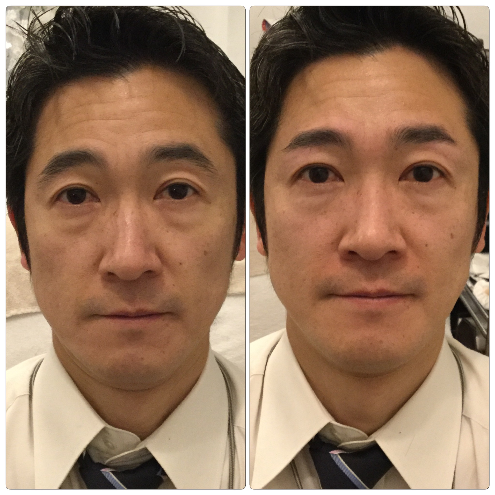 ビフォーアフター 横浜のメンズ専用の眉サロン眉男革命だから出来る眉デザインが人生革命を起こす